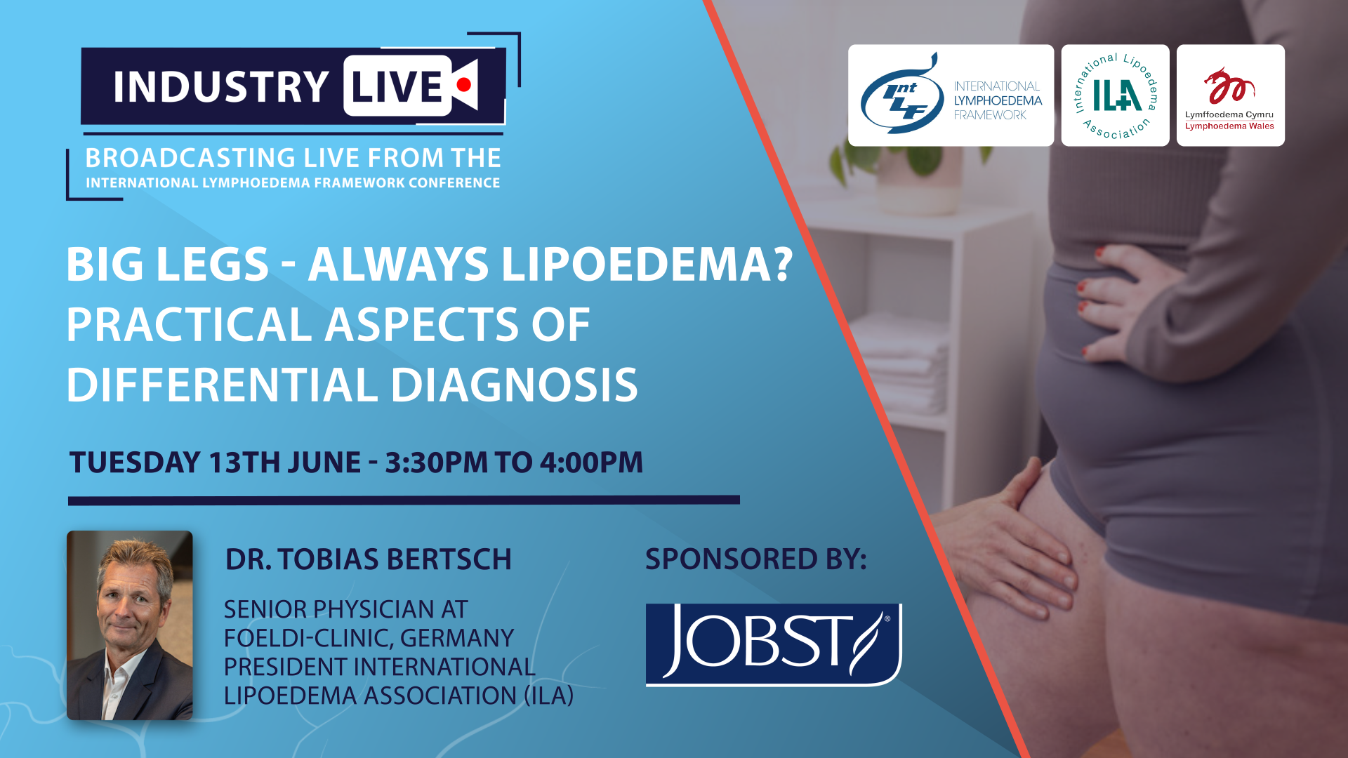 Big Legs - Always Lipoedema? Practical aspects of differential diagnosis